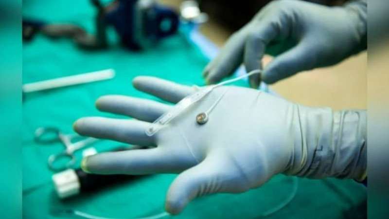 Kablosuz beyin implantı felçli hastalara umut oldu