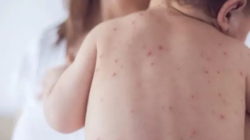 Avrupa ve Orta Asya'da çocuk aşılama oranları endişe verici seviyelerde